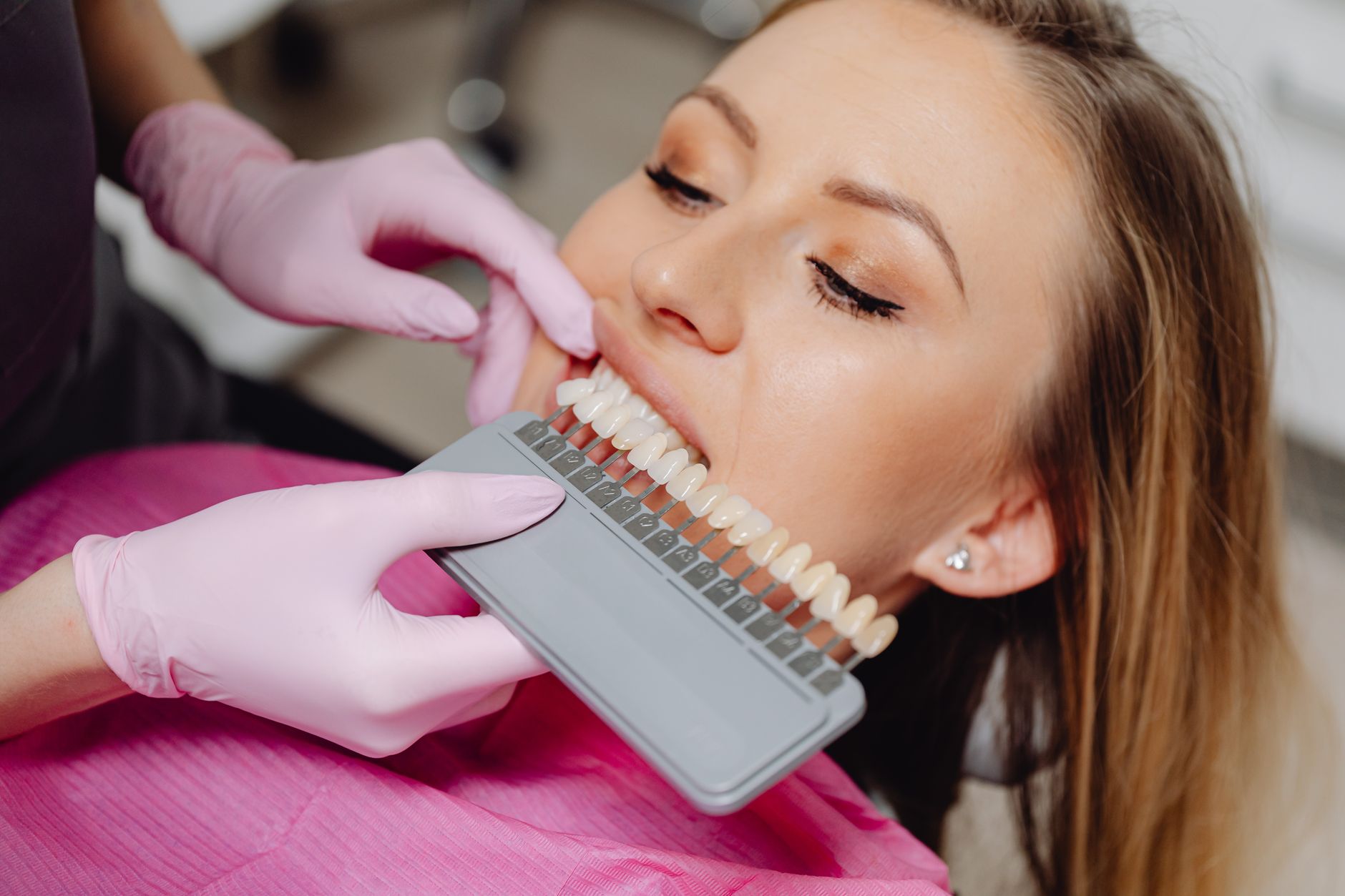 Everything To Consider Before Getting Cosmetic Dental Work
