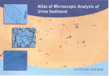 Atlas Urinsediment / Mikroskopi (MVA-fritt)