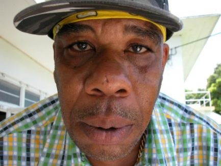 Burro Banton pictures