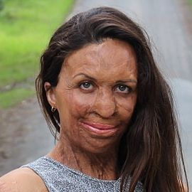 Turia Pitt Headshot