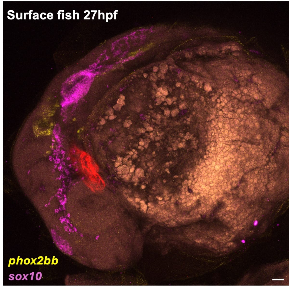 Migratory surface fish vagal neural crest cells (yellow and magenta)
(Perera et al., 2025)
