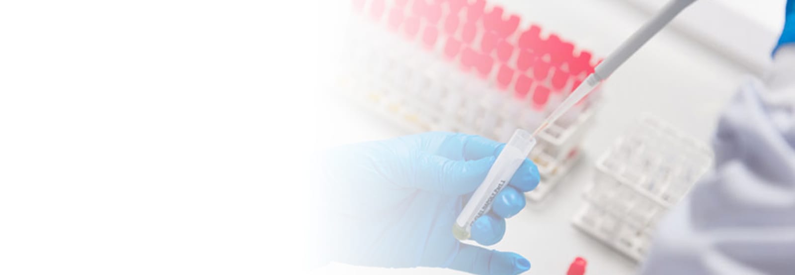 Immunochemistry