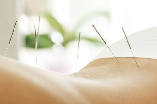 Acupunture - B&B Vento dei Cieli | Luxury rooms in Teora, Avellino