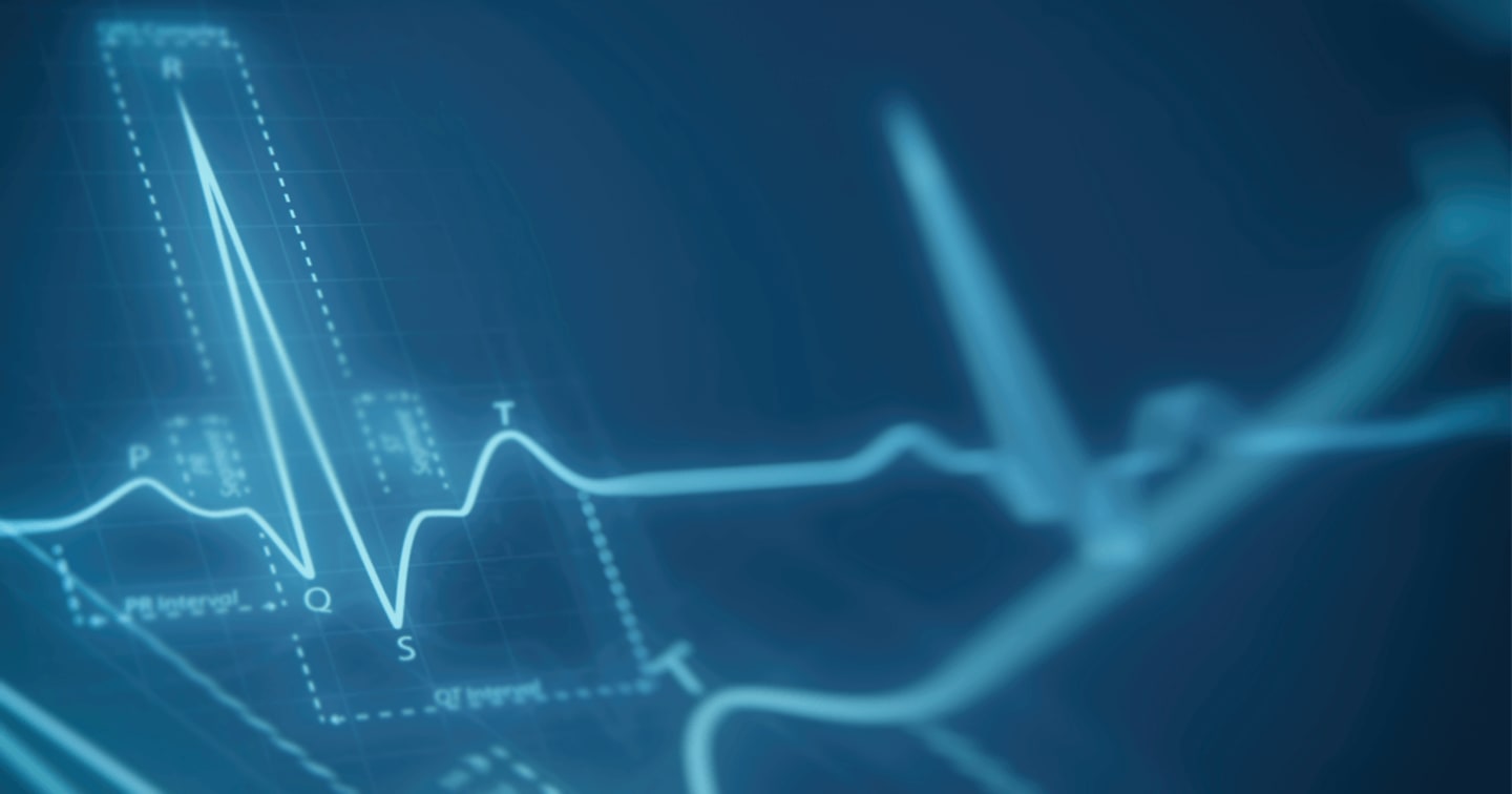 In image of an EKG.