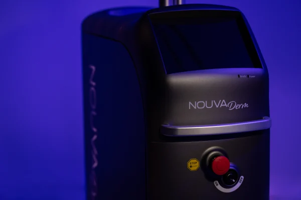 NOUVADerm laser treatment for skin laxity, melasma, and perioral lip lines
