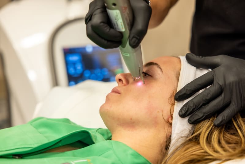 PLADUOpro SpinShot technology creating controlled microthermal zones for skin regeneration