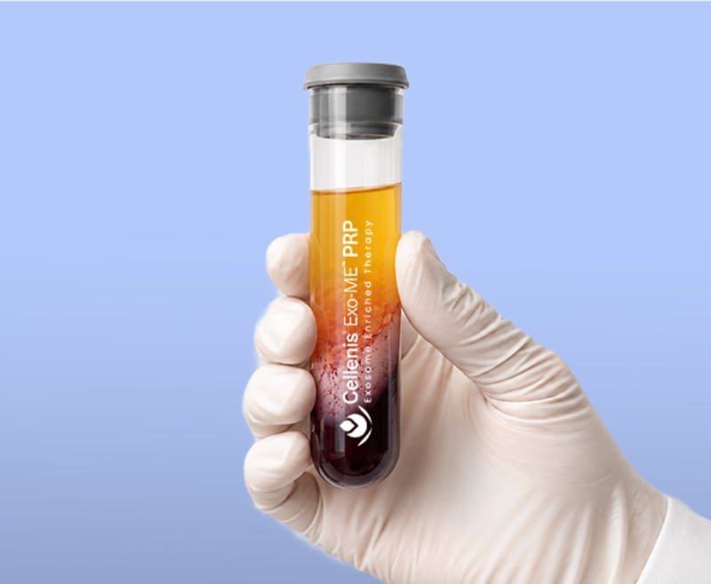 Exo-ME Biologic Treatment