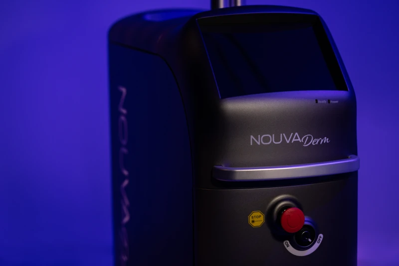 NOUVADerm laser treatment for skin laxity, melasma, and perioral lip lines