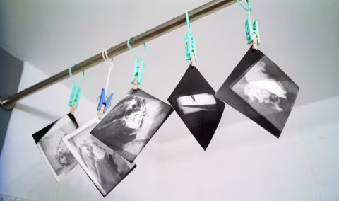 Finished prints drying on the shower rod.