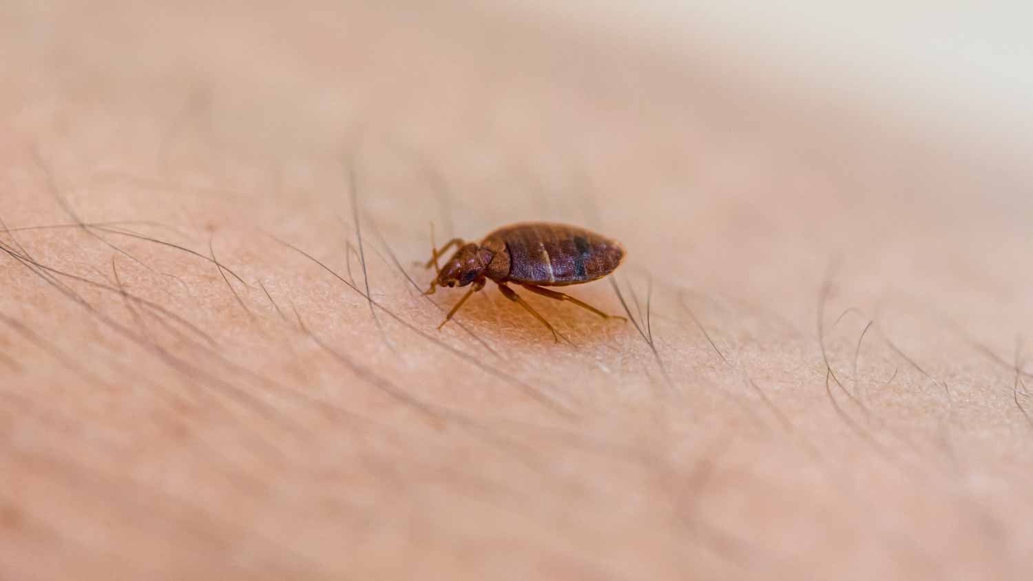 Bed bug on skin