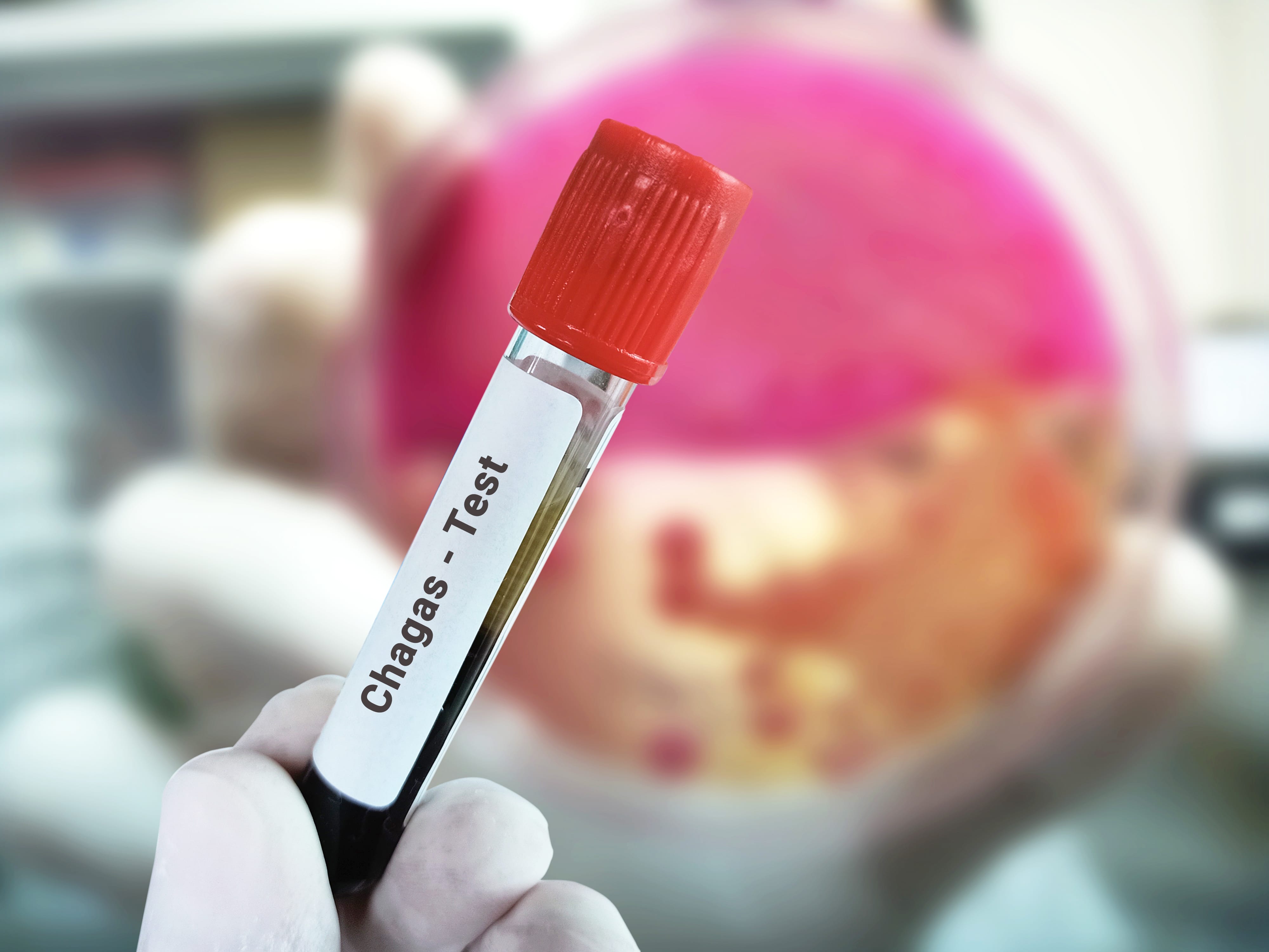 Blood sample to test Chagas disease