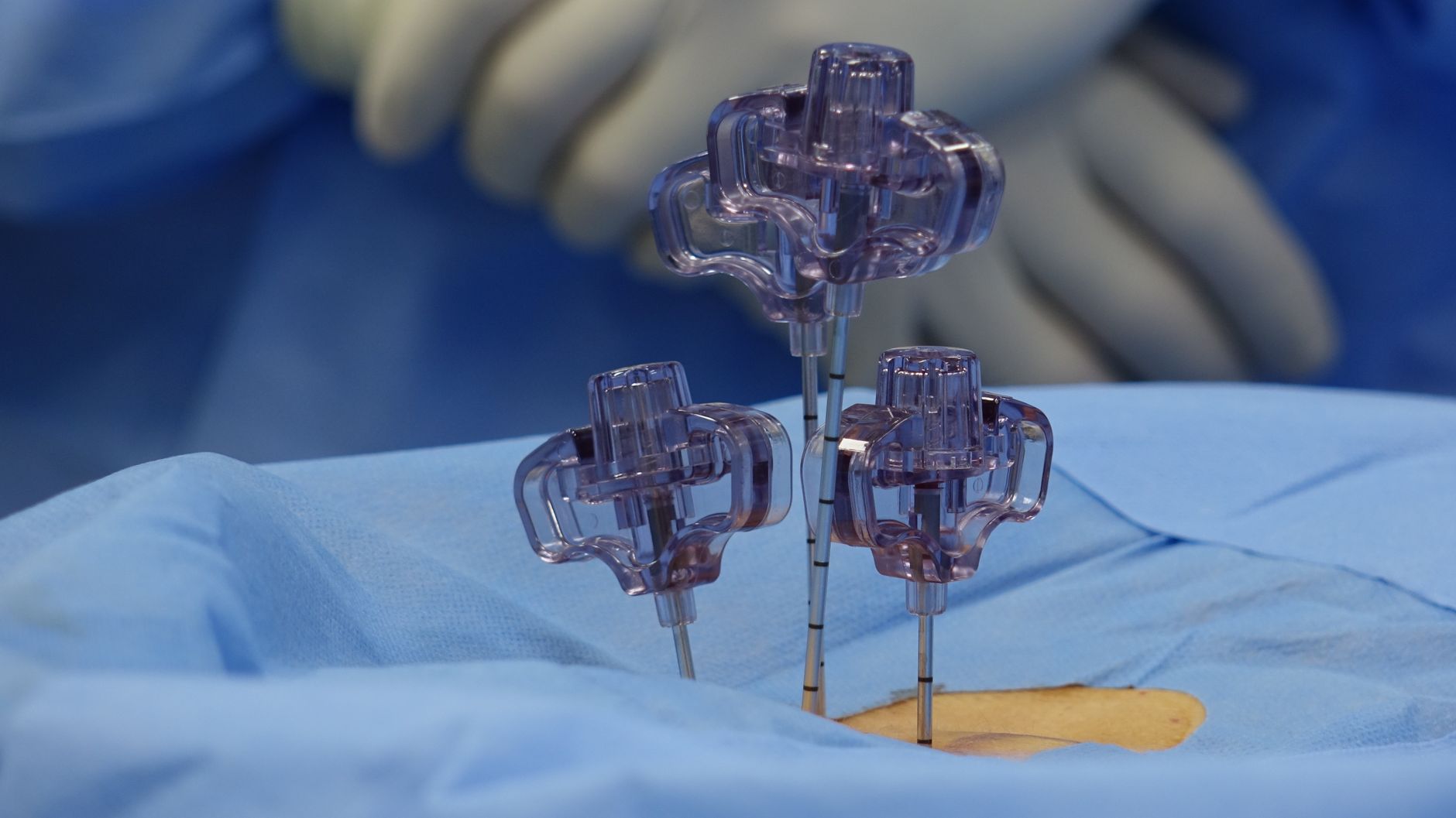 Spine Surgery – Is it the only way out ?