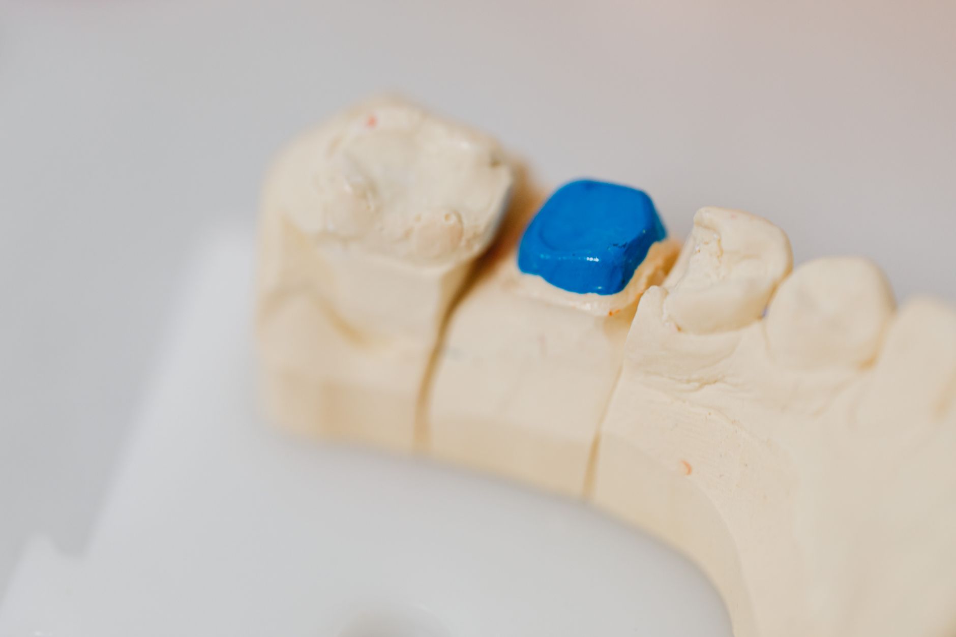 The Art And Science Of Cosmetic And Restorative Dentistry