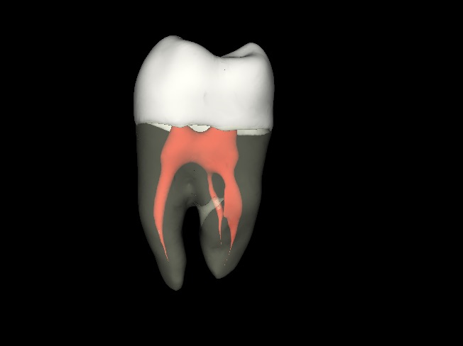 Upper Human Molar