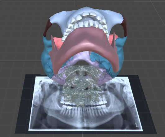 Augmented Reality Skull