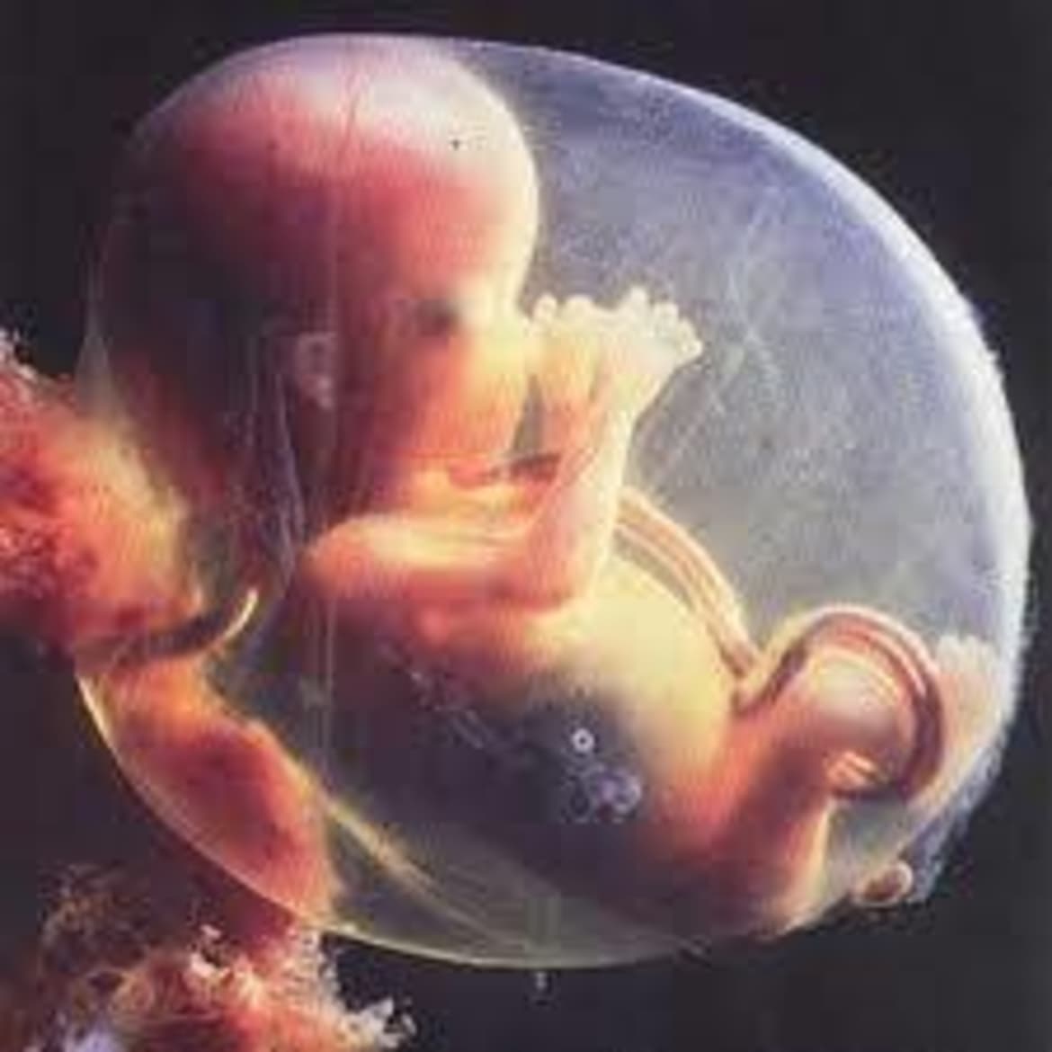 Embryo-1