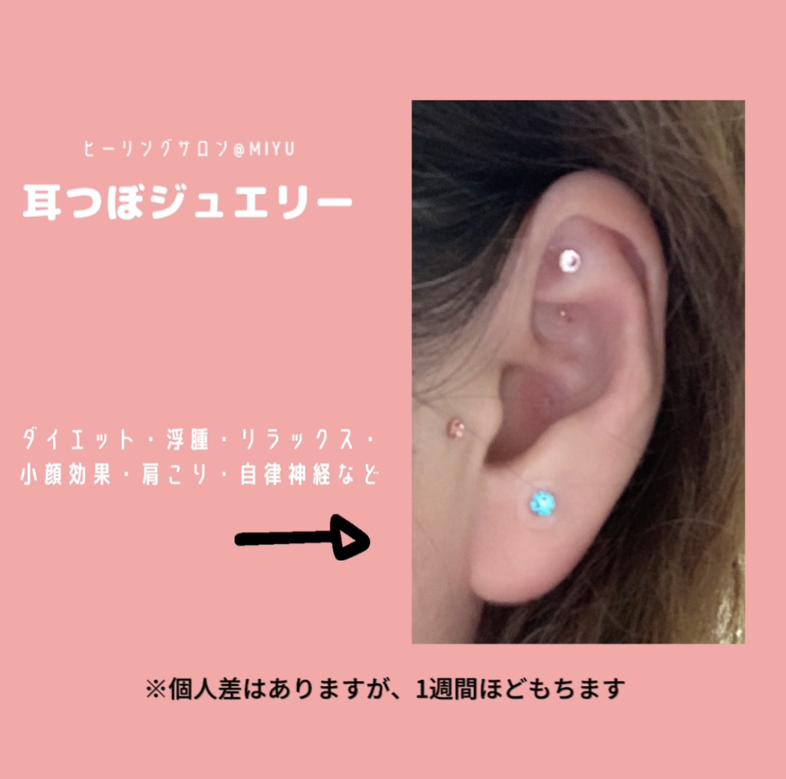 耳つぼジュエリー Tol