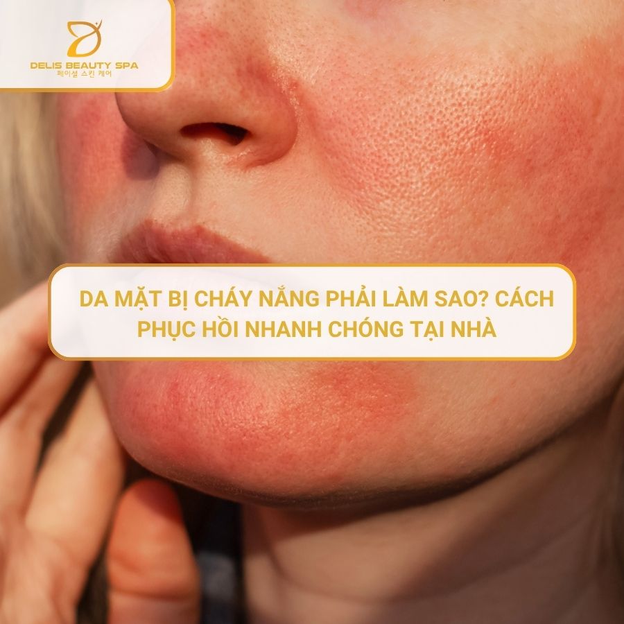 delis-spa-nha-trang