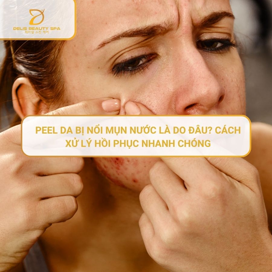 delis-spa-nha-trang