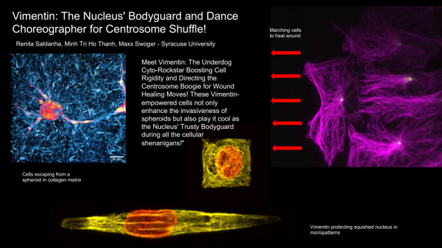 Vimentin: The Nucleus' Bodyguard and Dance Choreographer for Centrosome Shuffle | Renita, Saldanha, Syracuse University, rbsaldan@syr.edu Minh Tri- Ho Thanh,  Syracuse University, mhothanh@syr.edu Maxx,  Swoger, Syracuse University, mswoger@syr.edu