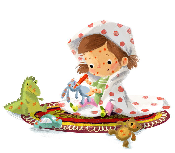 Chicken Pox - Arena Illustration Chicken Pox - Arena Illustration