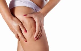 Tout savoir sur la cellulite