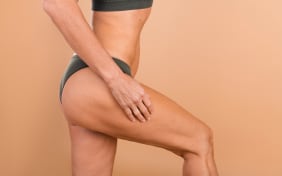 Cellulite sur les jambes : comment s'en débarrasser naturellement ?