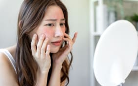 Urticaire visage : Causes et symptômes