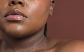 Traiter l'hyperpigmentation : conseils et solutions naturelles