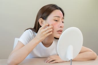 Urticaire allergique : causes, symptômes, solutions naturelles... tout savoir !