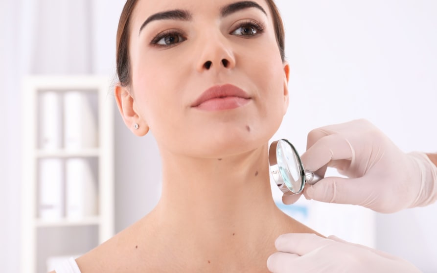 Grain de beauté qui saigne : que faire ? - Aroma-Zone