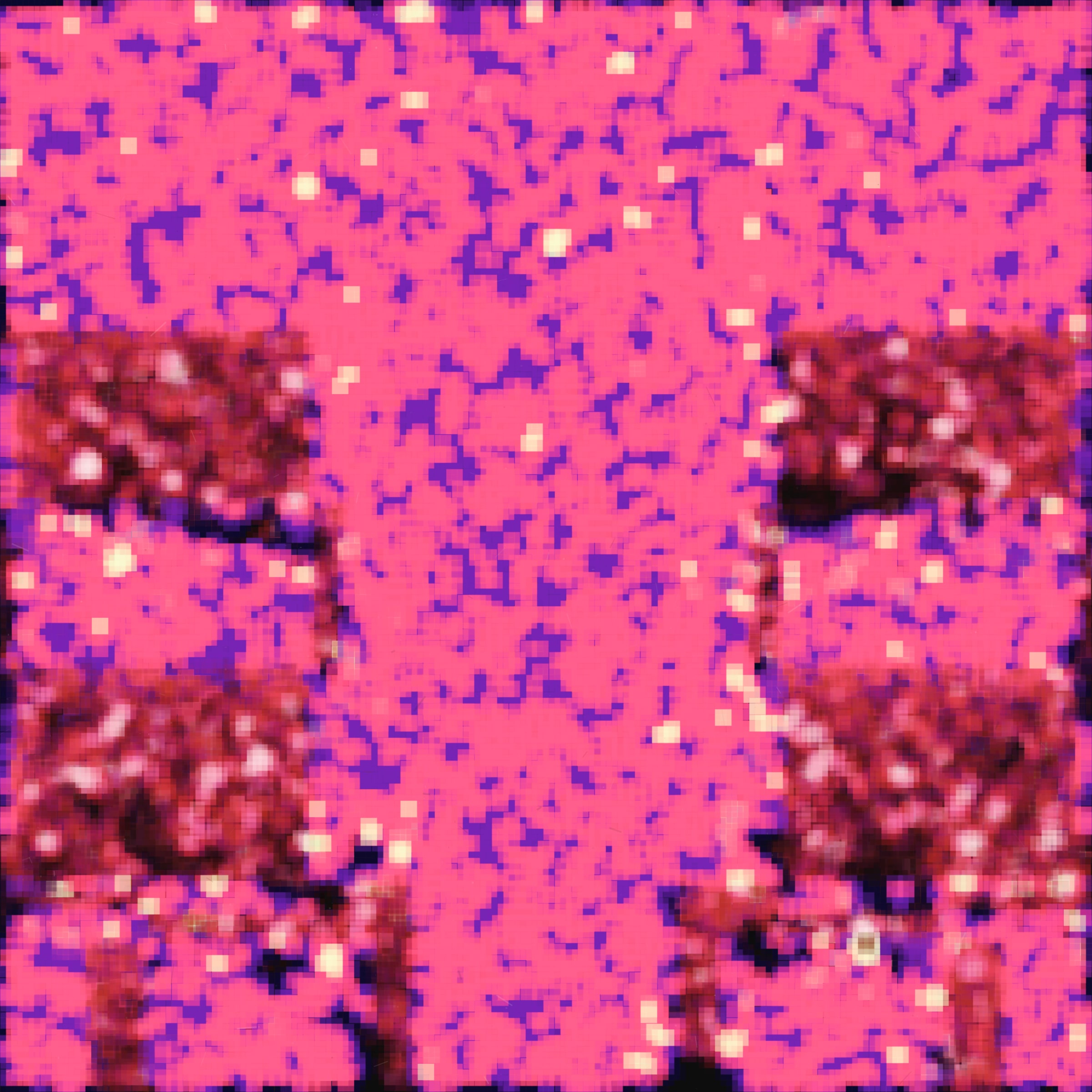 395000217