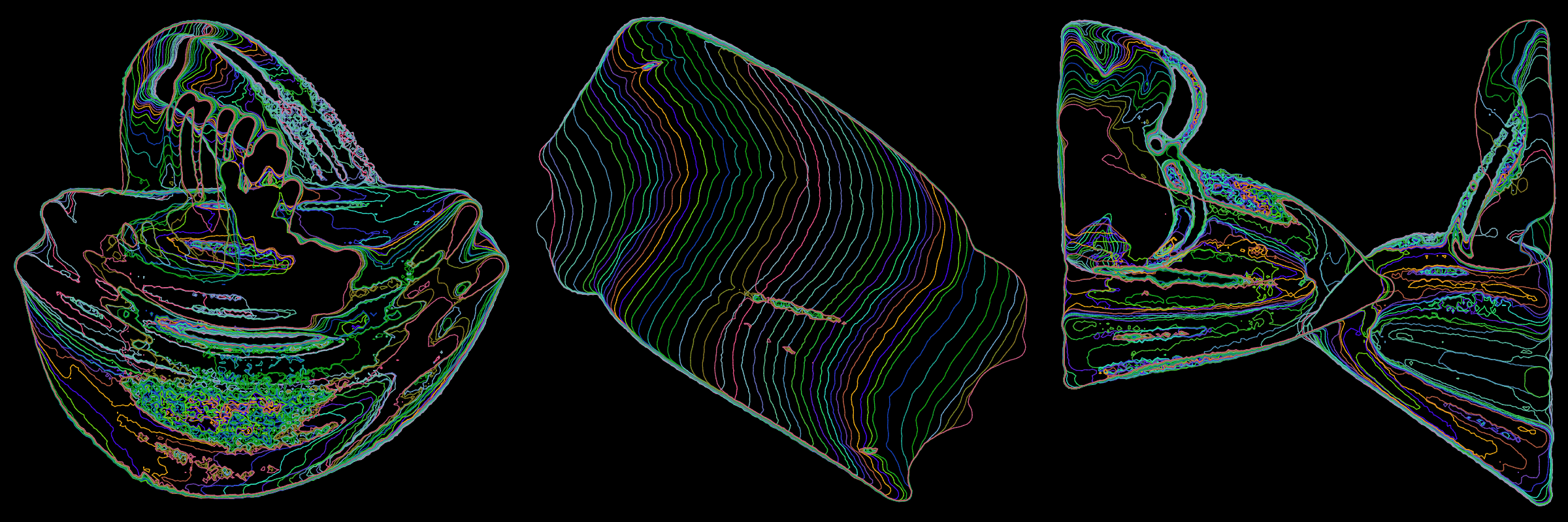 302000225