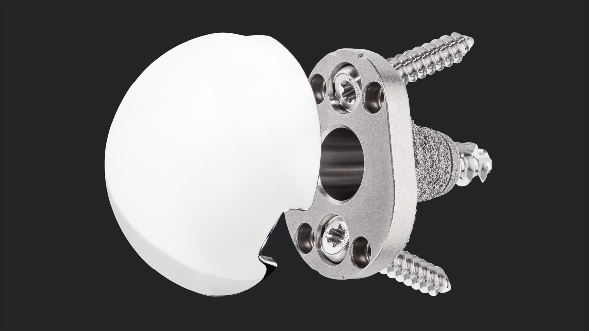 Universal Glenoid™ Convertible Baseplate for aTSA in the Dysplastic Glenoid