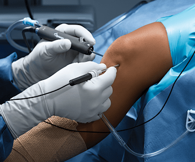 Nano Arthroscopy Homepage