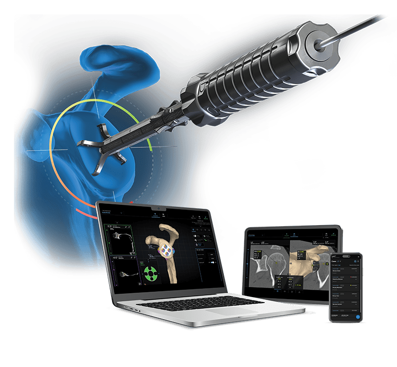 Sistema Virtual Implant Positioning<sup>™</sup> (VIP<sup>™</sup>)