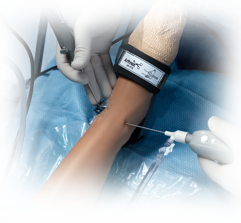 Nano Arthroscopy