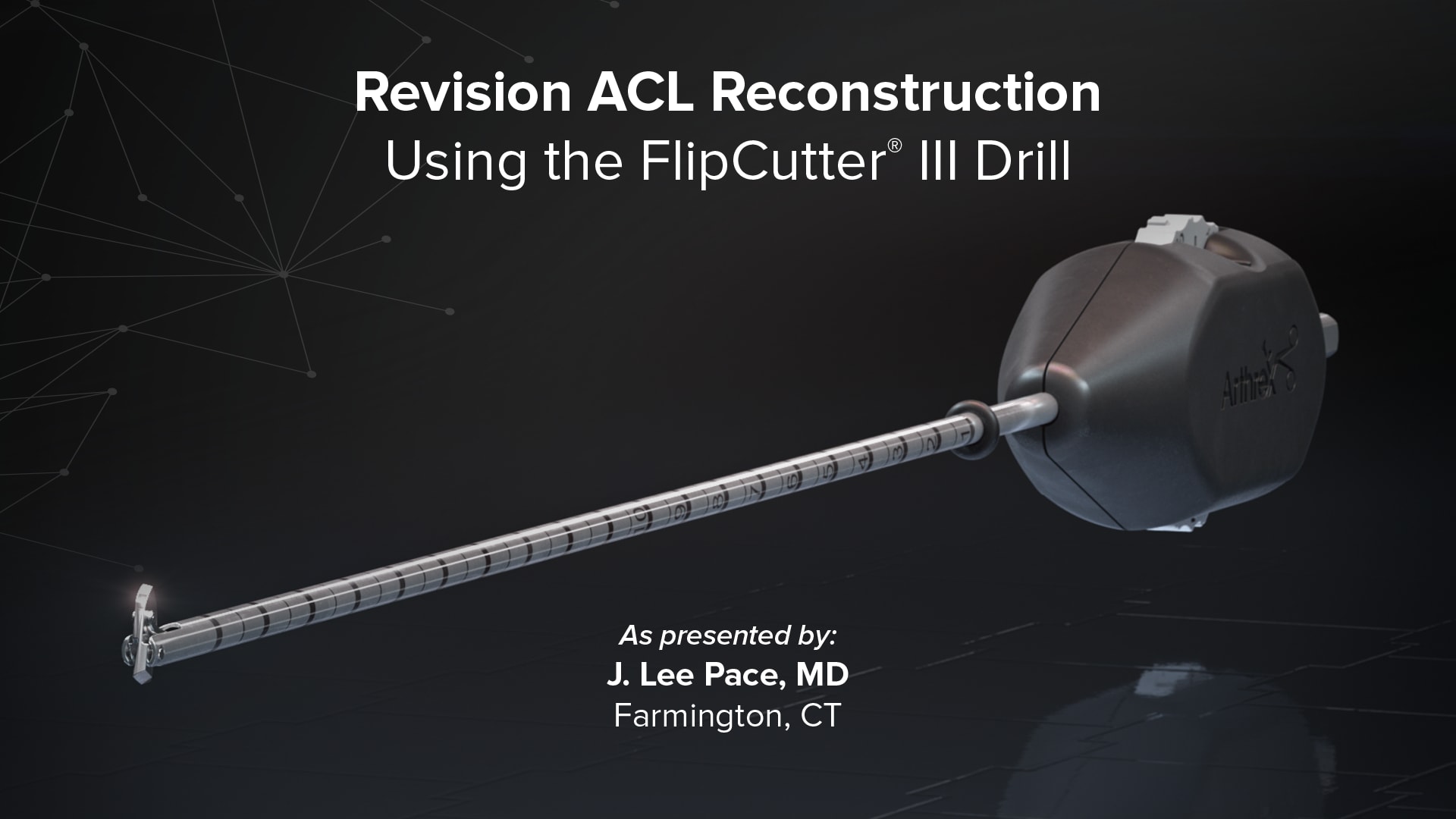 Revision ACL Reconstruction Using the FlipCutter® III Drill