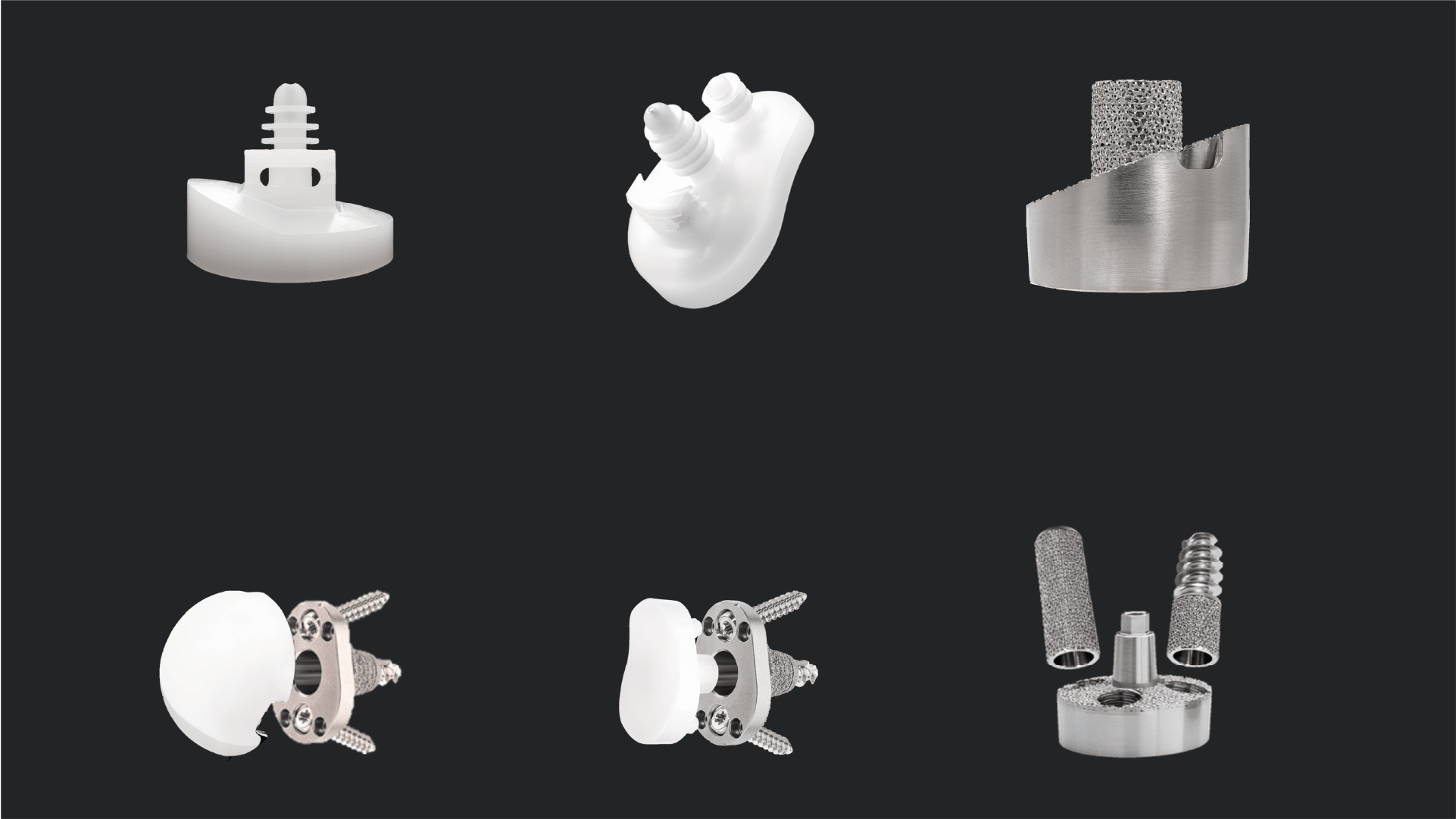 Glenoid Treatment Options: Managing Complex Morphology With Augmented Implants