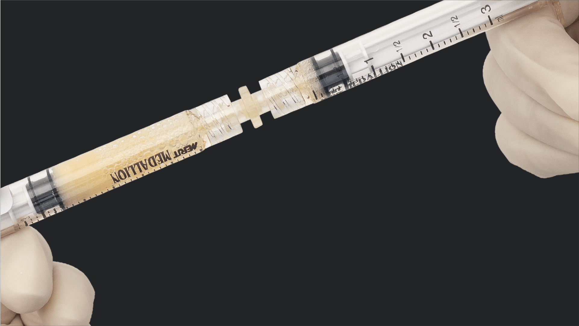 Biovance Amniotic Membrane and Interfyl Connective Tissue Matrix for Foot and Ankle Procedures