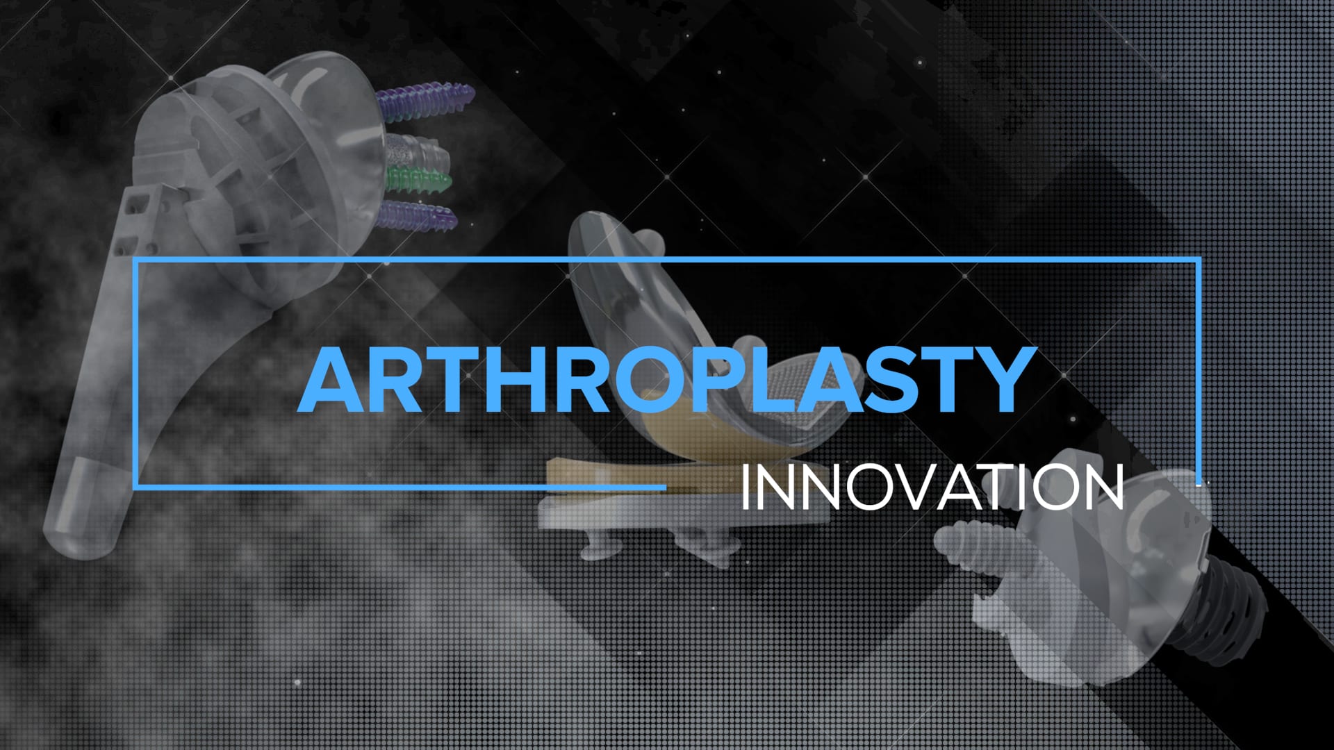 Arthrex - Arthroplasty Innovation