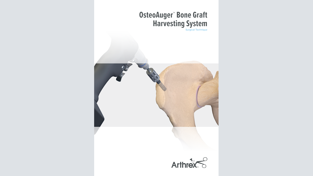 OsteoAuger™ Bone Graft Harvesting System