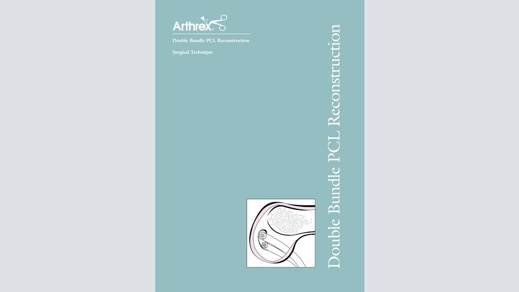 Double Bundle PCL Reconstruction