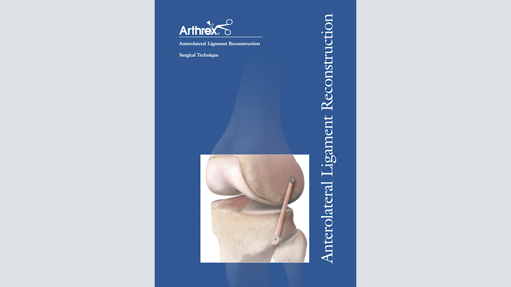 Anterolateral Ligament Reconstruction