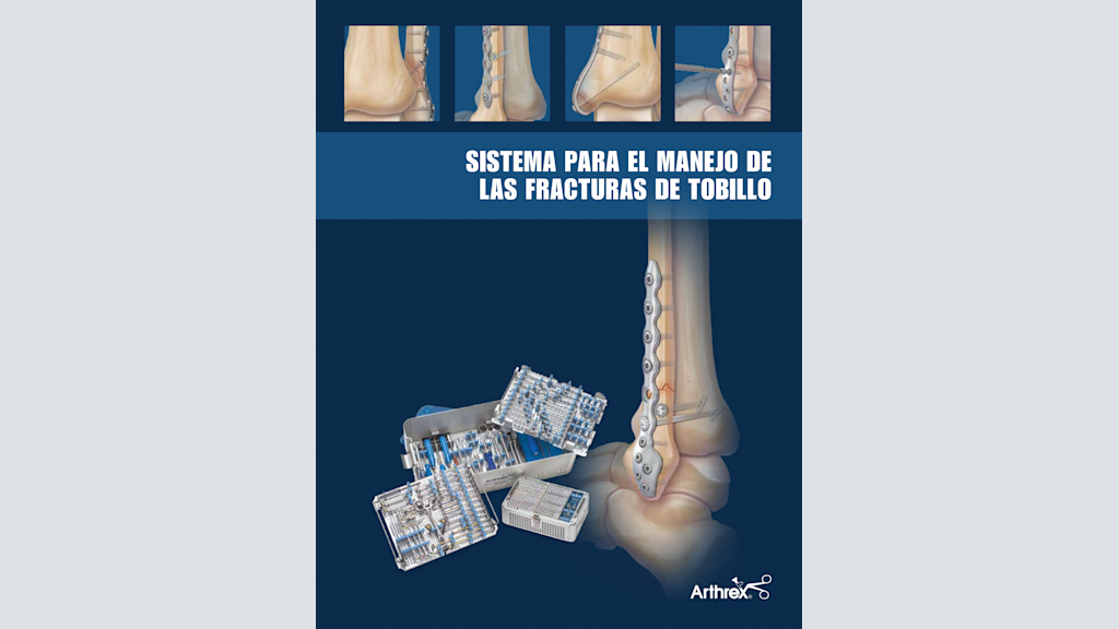 Sistema para el manejo de las fracturas de tobillo