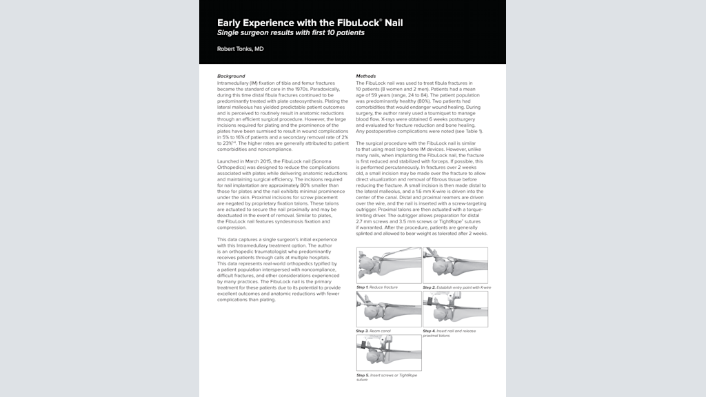 Early Experience with the FibuLock Nail® - Single surgeon results with the first 10 patients