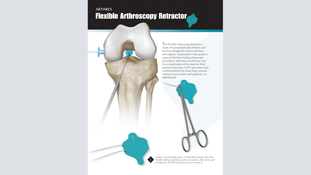 Arthrex Flexible Arthroscopy Retractor