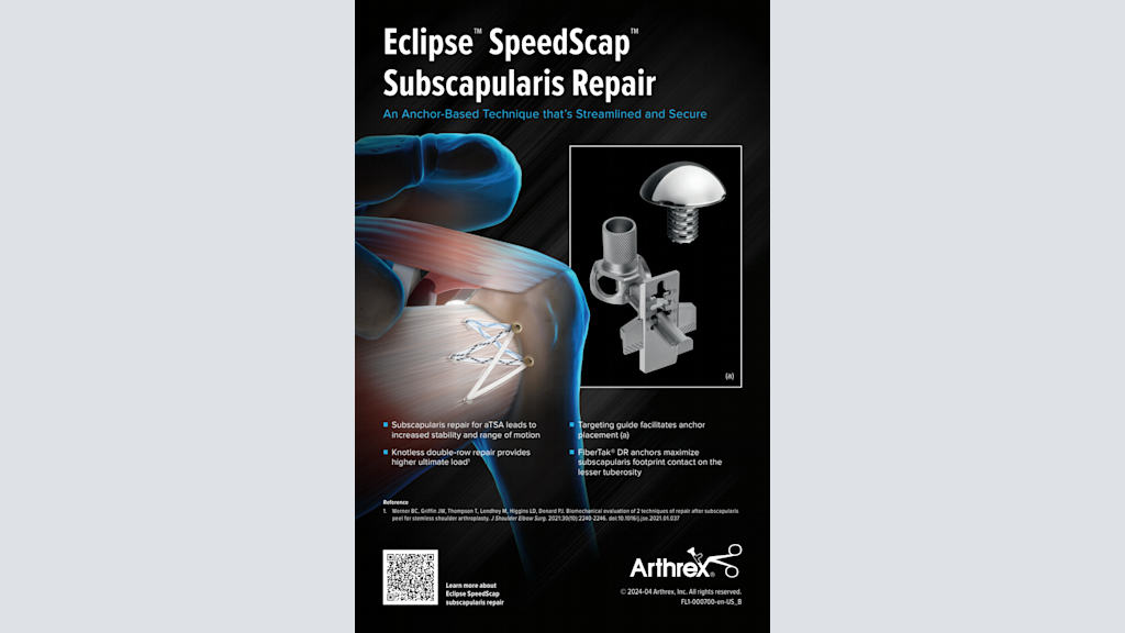 Eclipse™ SpeedScap™ Subscapularis Repair