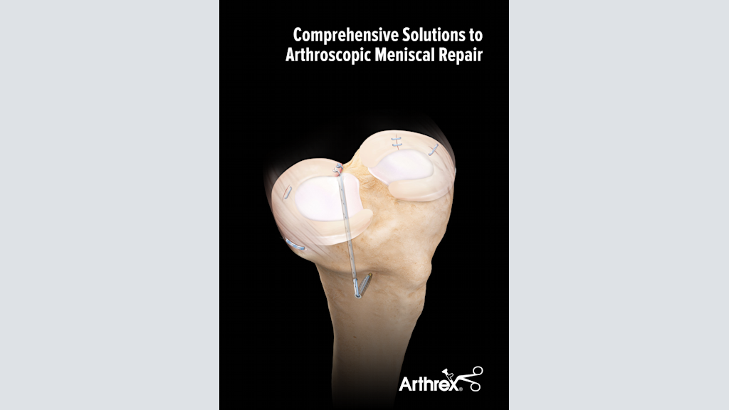 Comprehensive Solutions to Arthroscopic Meniscal Repair