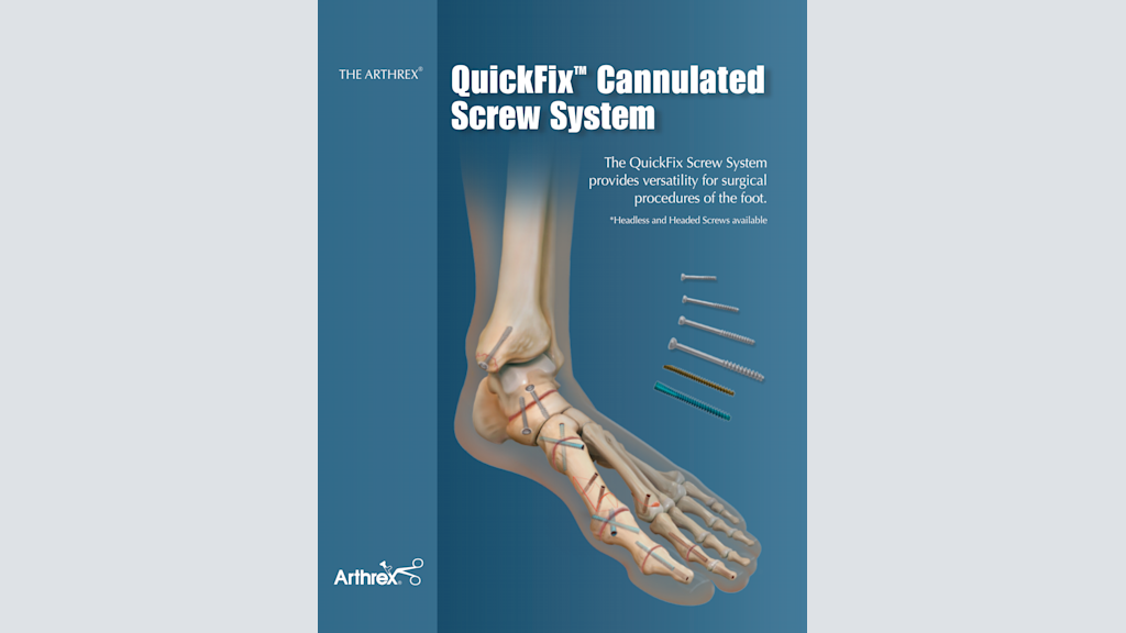 The Arthrex QuickFix™ Cannulated Screw System